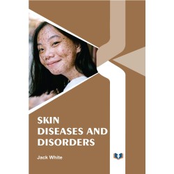 Skin Diseases And Disorders